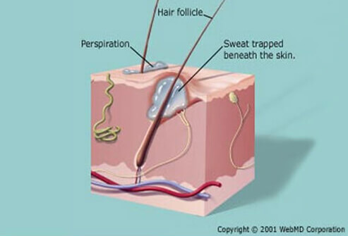 What Cause Skin Rashes In Adults What Cause Skin Rashes In Adults