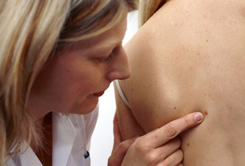 Disease Prevention in Women: Essential Screening Tests Every Woman Needs