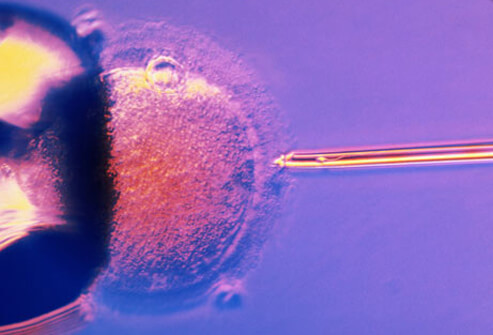Infertility: Which Treatment Is Right for You?