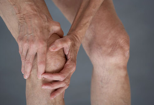Osteoarthritis (OA): Treatment, Symptoms, Diagnosis