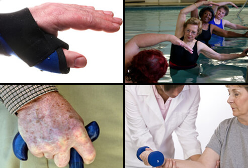 Rheumatoid Arthritis: Learn About RA Symptoms & Treatment