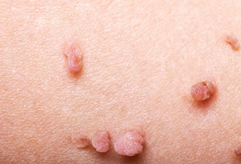 Skin Problems: Rashes, Bumps and Lumps