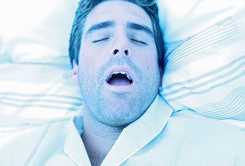 Sleep Disorders: Insomnia, Sleep Apnea, and More