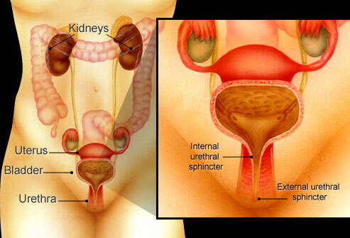 Urinary Incontinence in Women: Loss of Bladder Control?