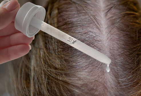Women’s Hair Loss: Thinning Hair Causes, Treatments and Solutions