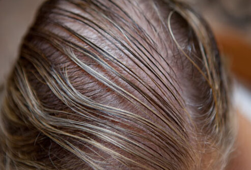 Women’s Hair Loss: Thinning Hair Causes, Treatments and Solutions